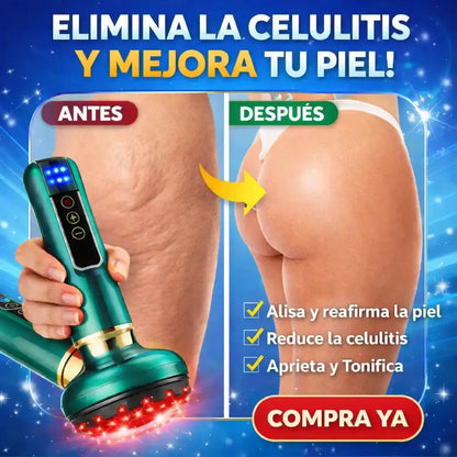CelluLuxe™ | Reduce la apariencia de la celulitis para que no vuelvas a esconder tu piel!